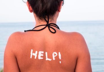 Come curare le scottature da sole con 10 rimedi naturali ...
