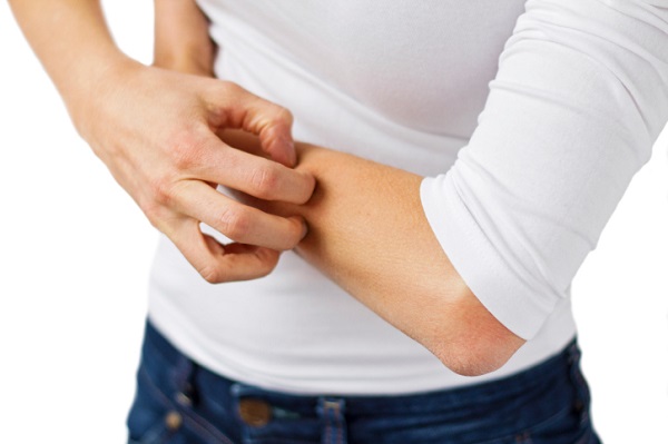 Come curare la dermatite seborroica 