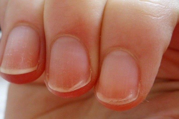 Come curare le unghie fragili  