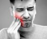 Come far passare il mal di denti 